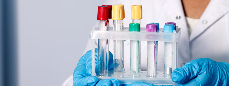 Анализы в клинике El’cosmo