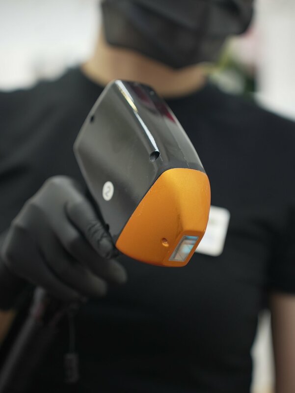 lazernaja-epiljacija-1