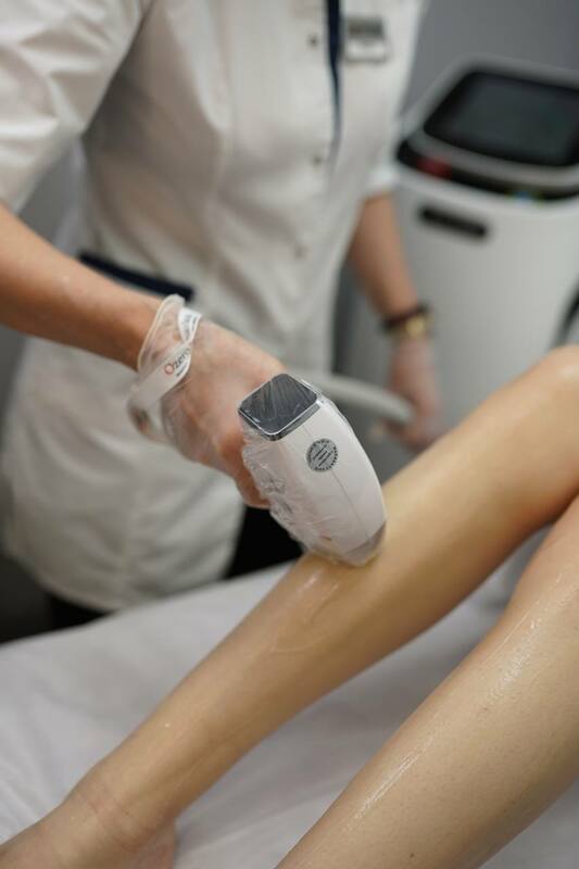 lazernaja-epiljacija-5