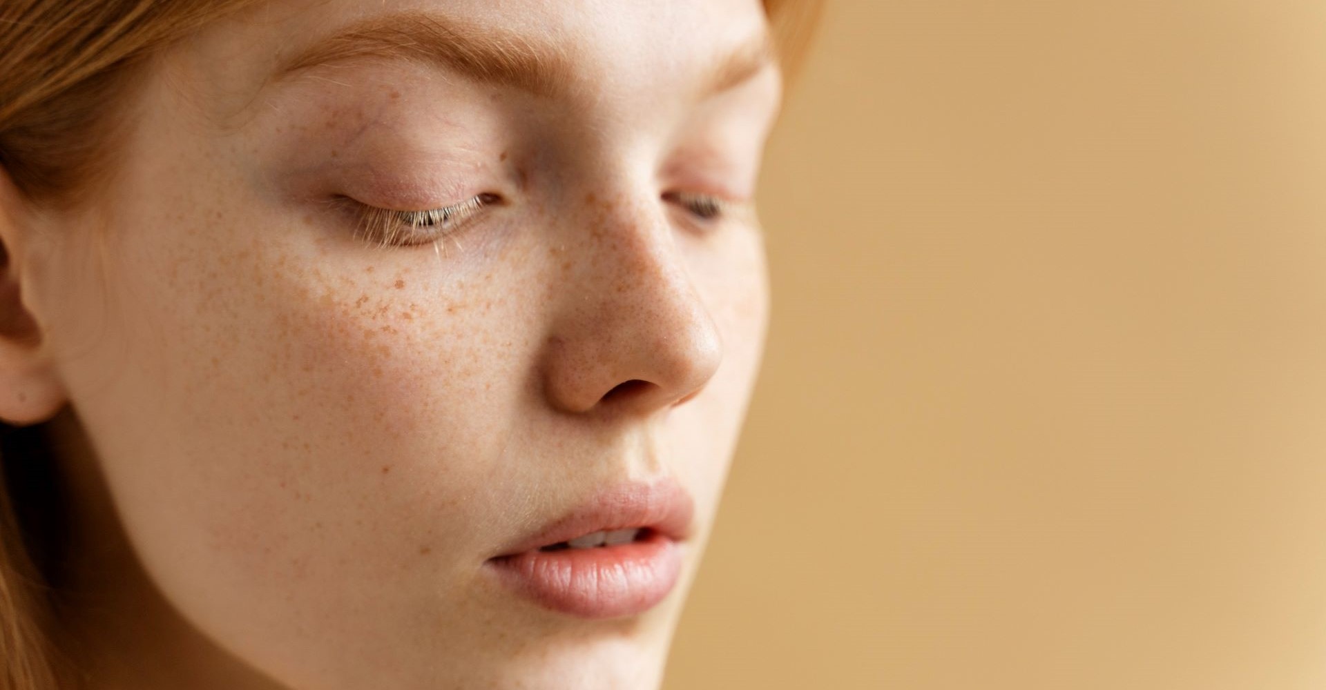 Как избавиться от пигментных пятен: от домашнего ухода до эстетических процедур