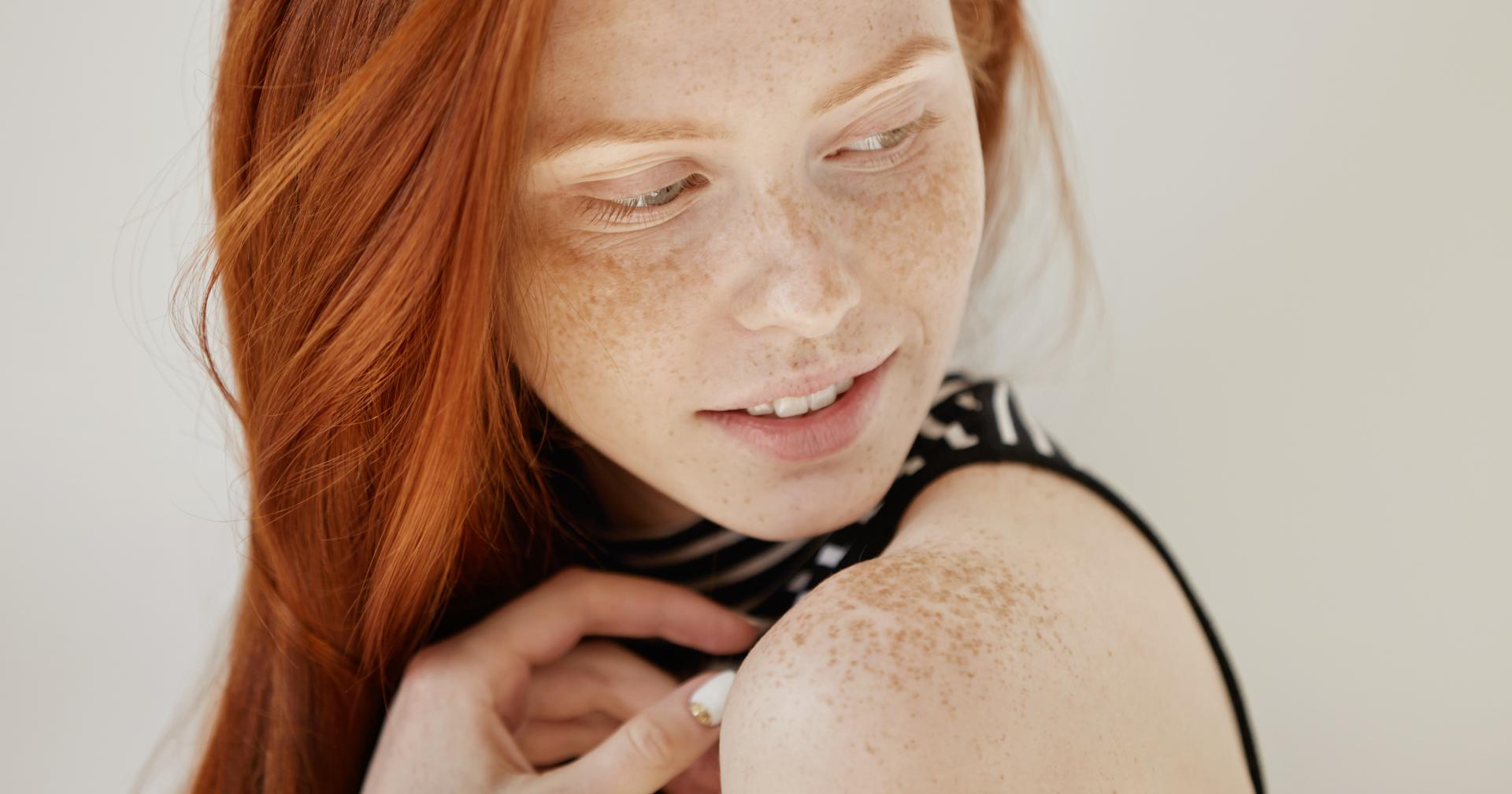 Пигментация кожи: причины возникновения и методы решения проблемы